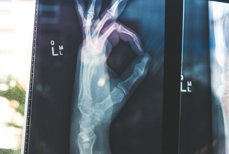 citiscan result hand ok